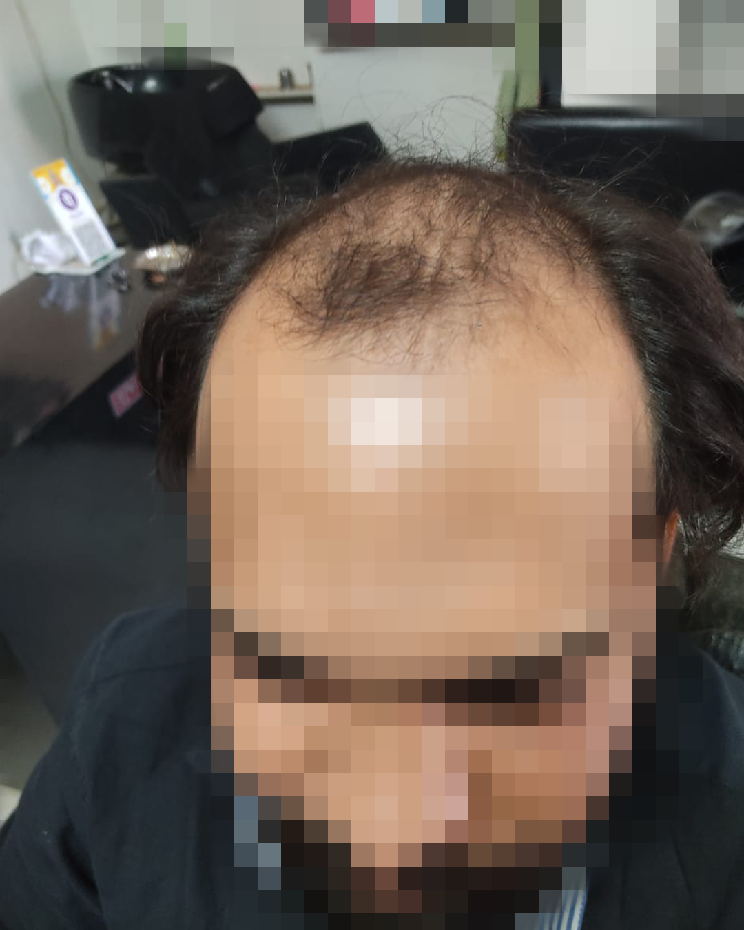 image 1 before upload website image 1 before upload website