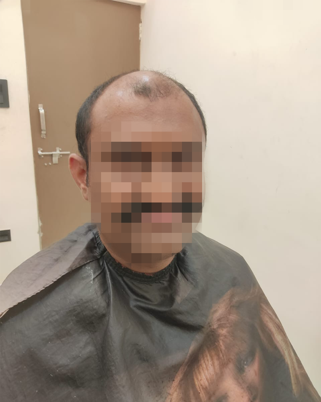 image 3 upload before image 3 upload before